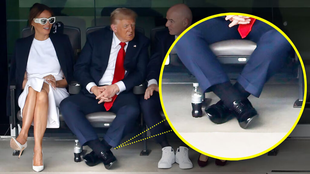 President Trump ankle swelling at FIFA event July 2025