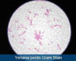 Yersinia pestis bacteria under microscope - cause of bubonic plague